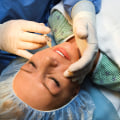 Negotiating the Price of Plastic Surgery: Tips from an Expert