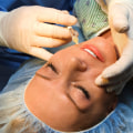 Negotiating Prices for Plastic Surgery: Tips from an Expert