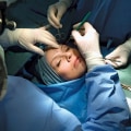 The Transformative Power of Plastic Surgery