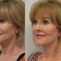 The Art of Plastic Surgery: Enhancing Beauty and Quality of Life
