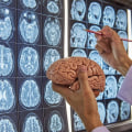 The Top-Paying Medical Job: Neurosurgery - An Expert's Perspective