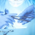 Plastic Surgery: Understanding the Difference Between a Plastic Surgeon and a Cosmetic Surgeon