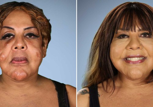 What are the highest rated plastic surgery procedures?