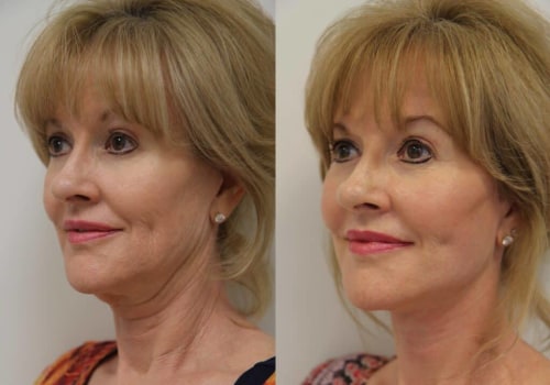The Art of Plastic Surgery: Enhancing Beauty and Quality of Life
