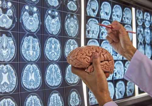 The Top-Paying Medical Job: Neurosurgery - An Expert's Perspective